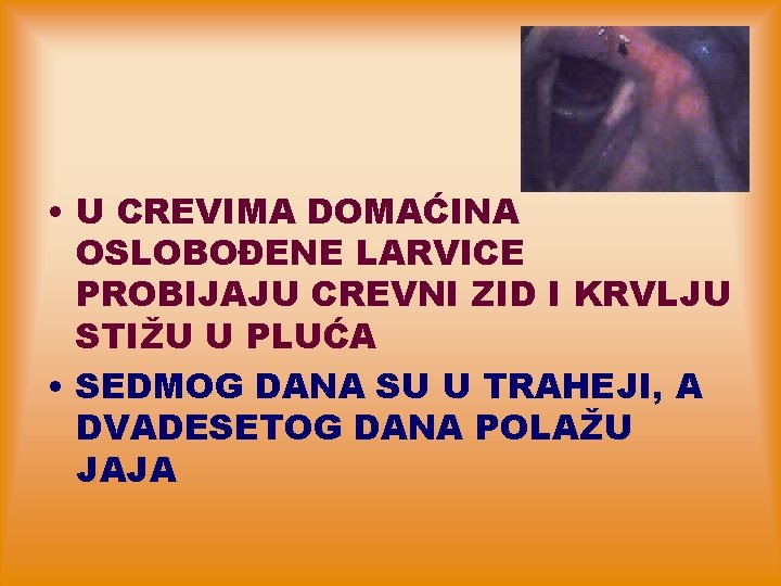  • U CREVIMA DOMAĆINA OSLOBOĐENE LARVICE PROBIJAJU CREVNI ZID I KRVLJU STIŽU U