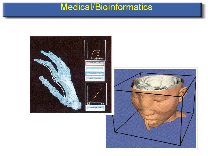 Medical/Bioinformatics 