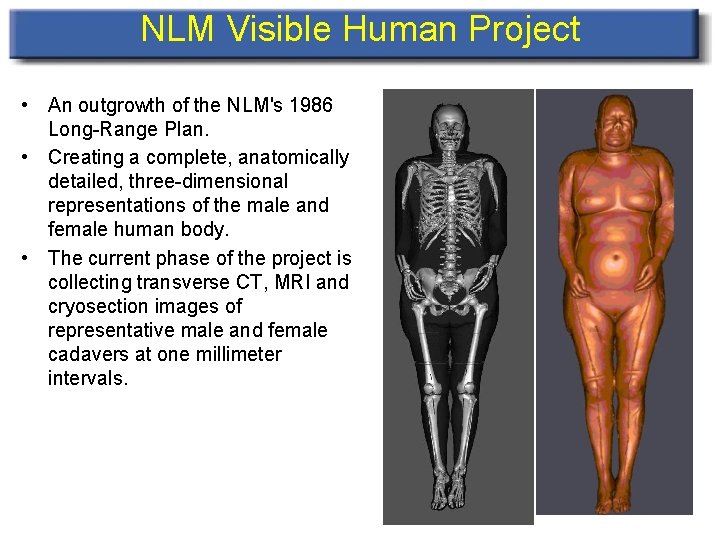NLM Visible Human Project • An outgrowth of the NLM's 1986 Long-Range Plan. •