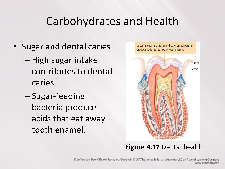 Carbohydrates and Health • Sugar and dental caries – High sugar intake contributes to