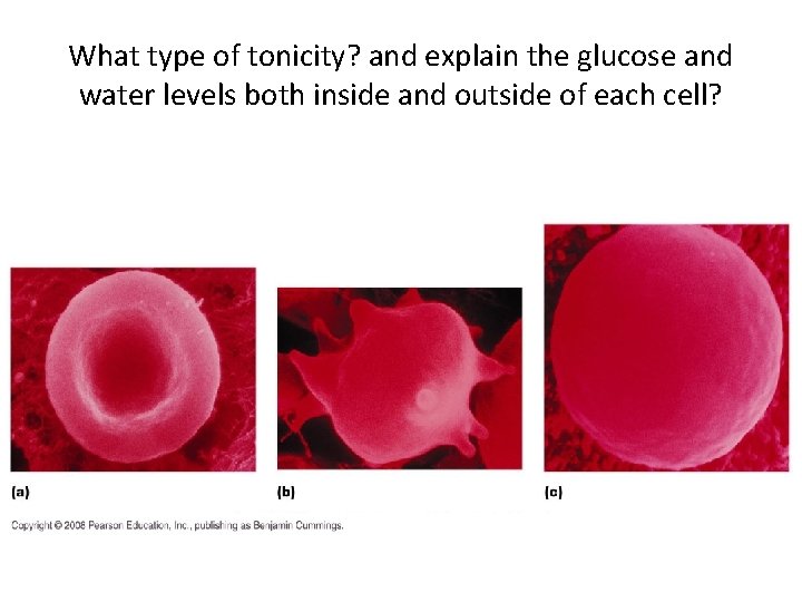 What type of tonicity? and explain the glucose and water levels both inside and