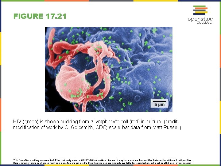 FIGURE 17. 21 HIV (green) is shown budding from a lymphocyte cell (red) in