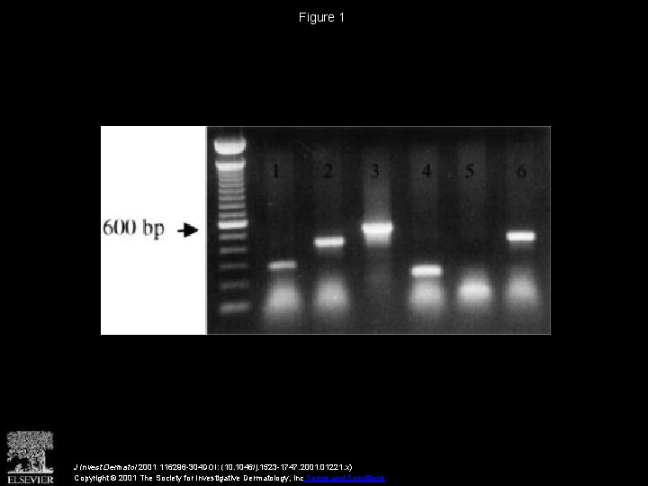 Figure 1 J Invest Dermatol 2001 116296 -304 DOI: (10. 1046/j. 1523 -1747. 2001.