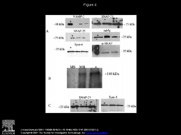 Figure 4 J Invest Dermatol 2001 116296 -304 DOI: (10. 1046/j. 1523 -1747. 2001.