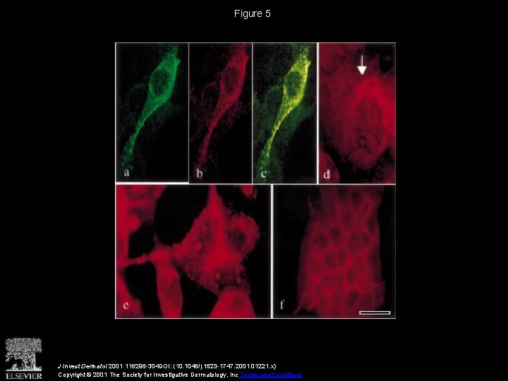 Figure 5 J Invest Dermatol 2001 116296 -304 DOI: (10. 1046/j. 1523 -1747. 2001.