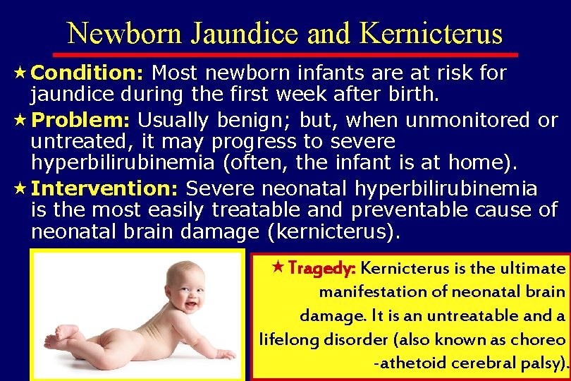 Newborn Jaundice and Kernicterus « Condition: Most newborn infants are at risk for jaundice