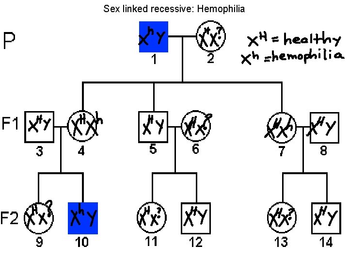 Sex linked recessive: Hemophilia 