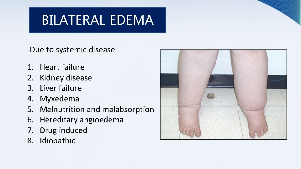 Lower Limb Edema A Systemic Approach By Pbl