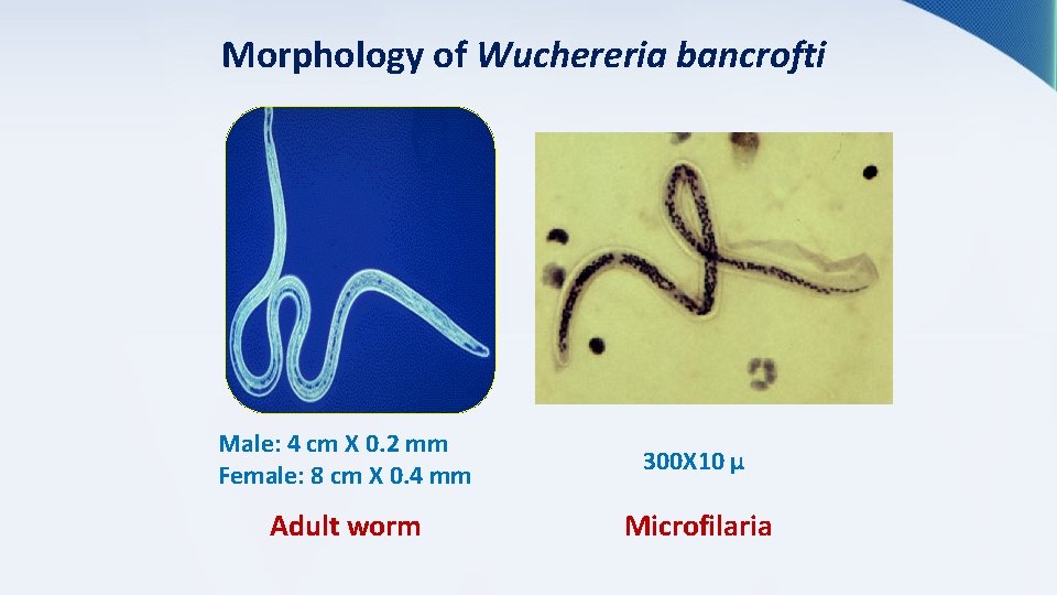 Morphology of Wuchereria bancrofti Male: 4 cm X 0. 2 mm Female: 8 cm