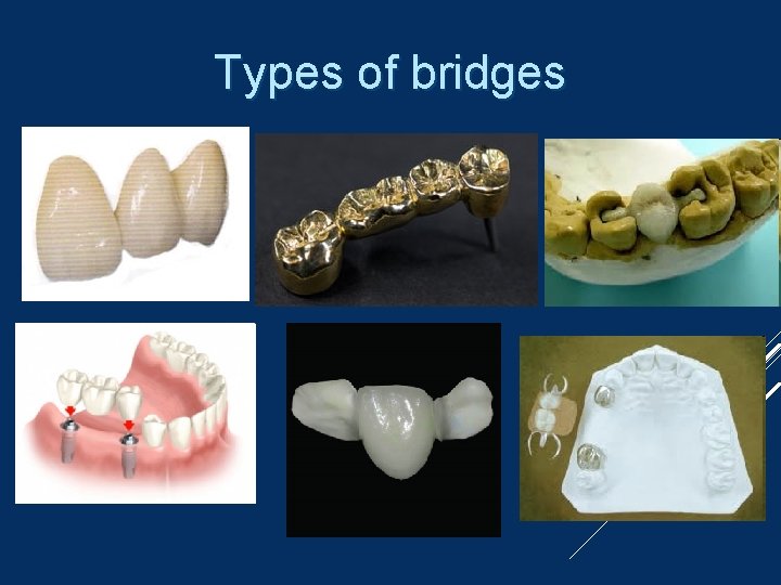 Types of bridges 