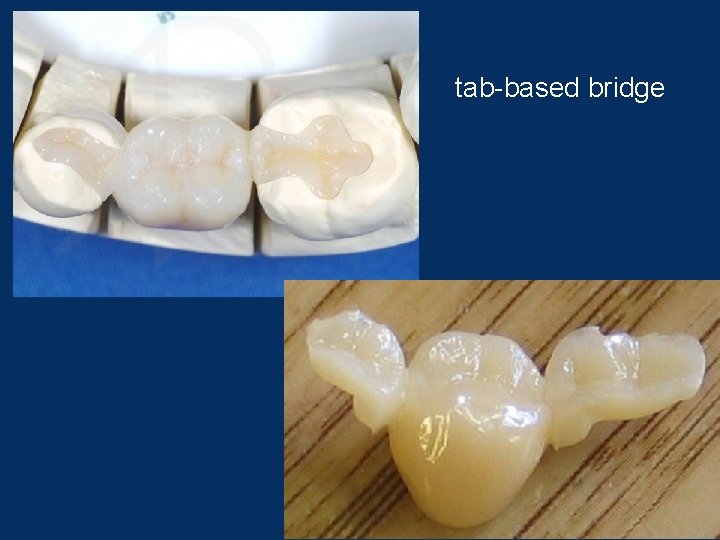Partial absence of teeth Classification of defects of