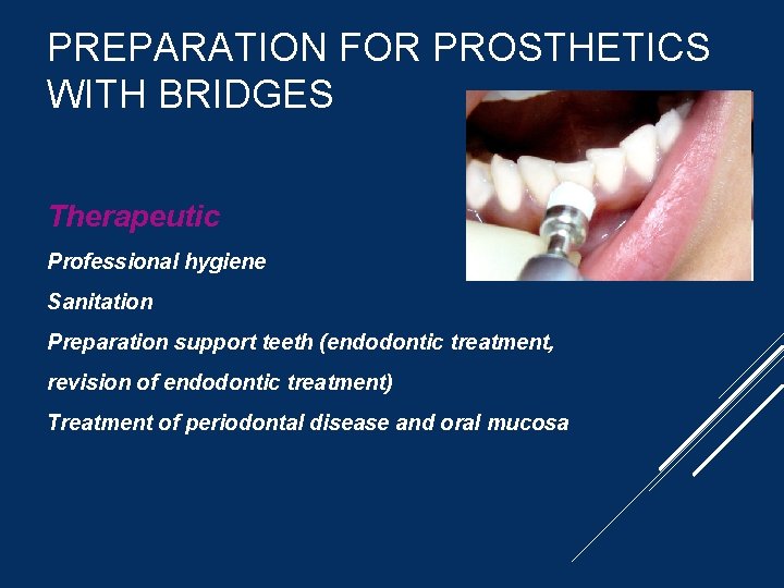 PREPARATION FOR PROSTHETICS WITH BRIDGES Therapeutic Professional hygiene Sanitation Preparation support teeth (endodontic treatment,