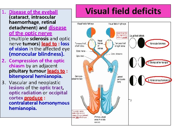 1. Disease of the eyeball (cataract, intraocular haemorrhage, retinal detachment) and disease of the