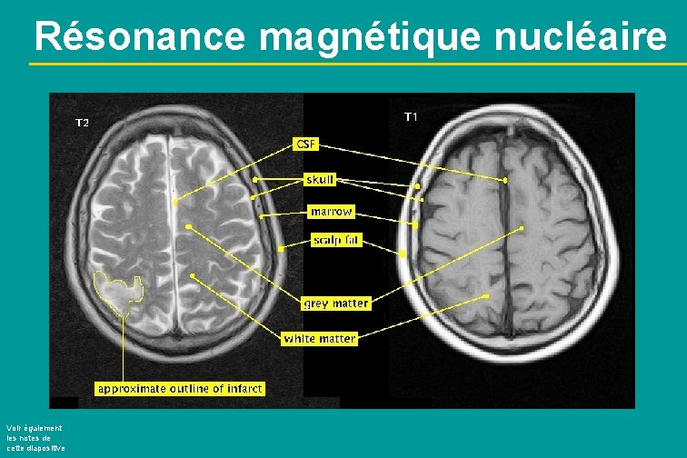 Résonance magnétique nucléaire Voir également les notes de cette diapositive 