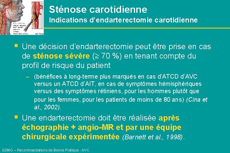 Sténose carotidienne Indications d’endarterectomie carotidienne § Une décision d’endarterectomie peut être prise en cas