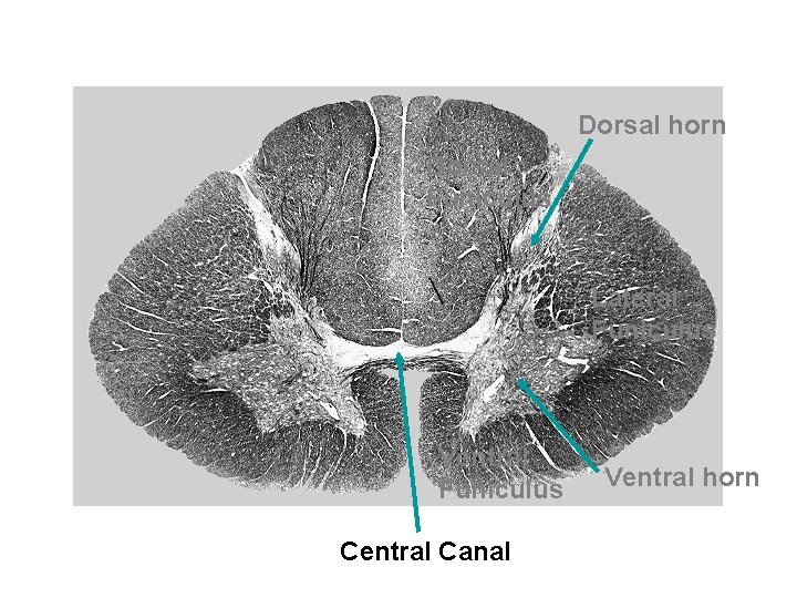 Dorsal horn Dorsal Funiculus Lateral Funiculus Ventral Funiculus Central Canal Ventral horn 