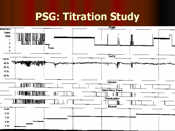 PSG: Titration Study 