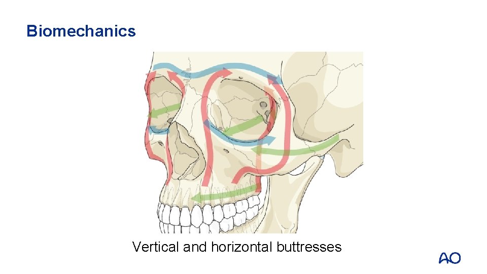 Biomechanics Vertical and horizontal buttresses 