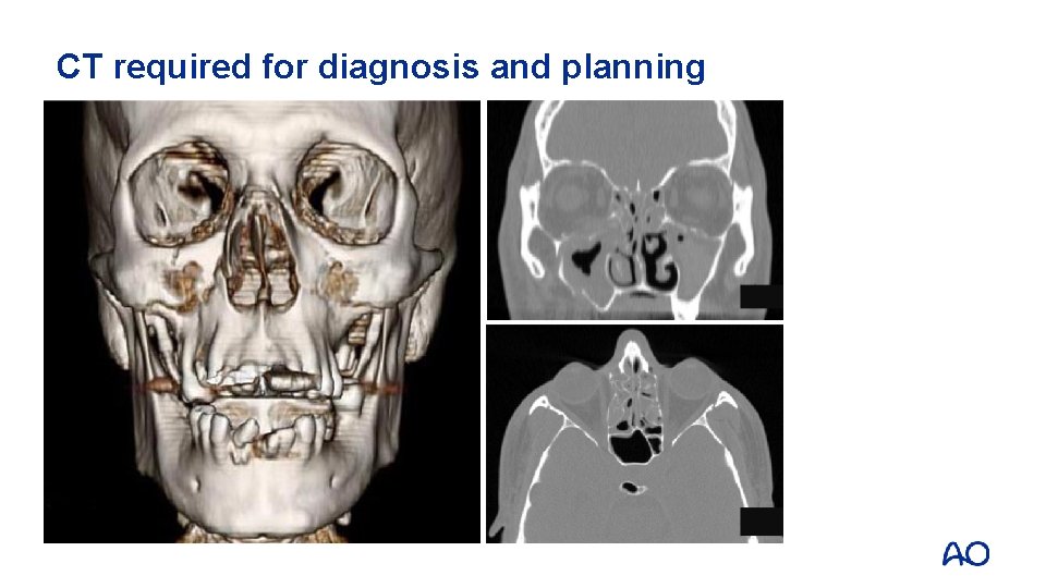 CT required for diagnosis and planning 