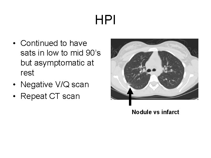 HPI • Continued to have sats in low to mid 90’s but asymptomatic at