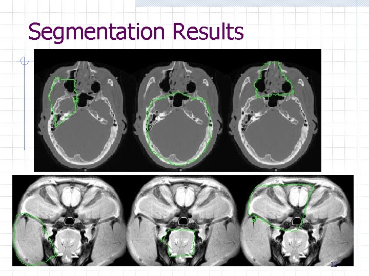 Segmentation Results 12 