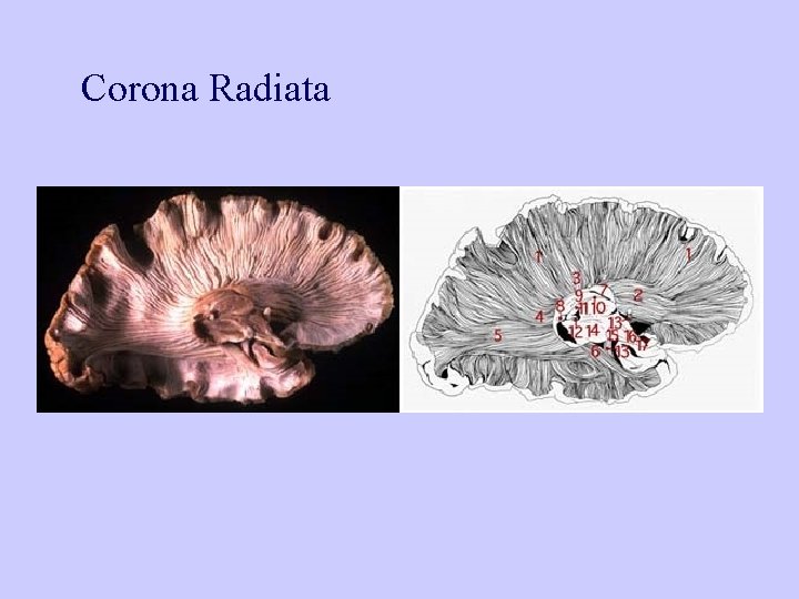 Corona Radiata 