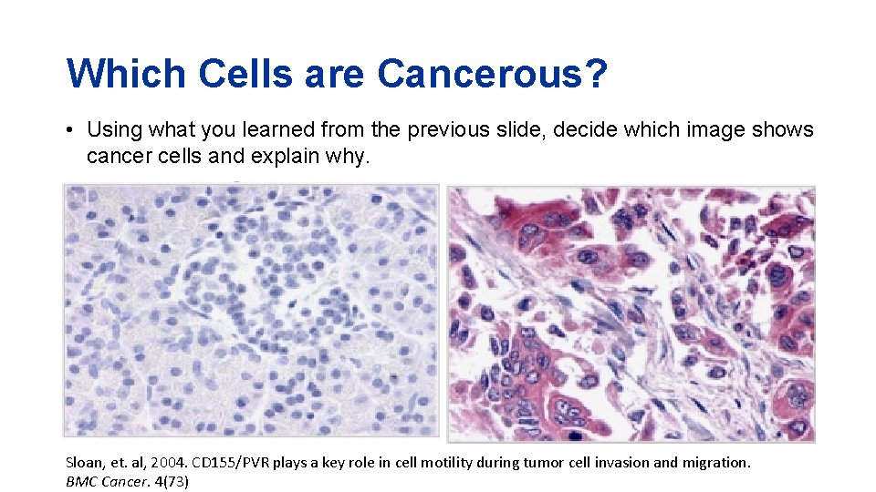 Which Cells are Cancerous? • Using what you learned from the previous slide, decide