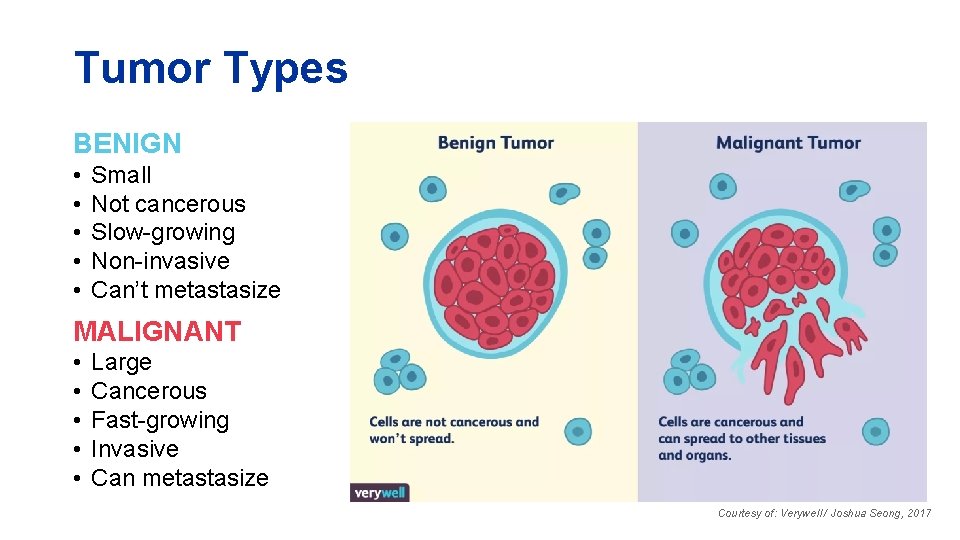 Tumor Types BENIGN • • • Small Not cancerous Slow-growing Non-invasive Can’t metastasize MALIGNANT