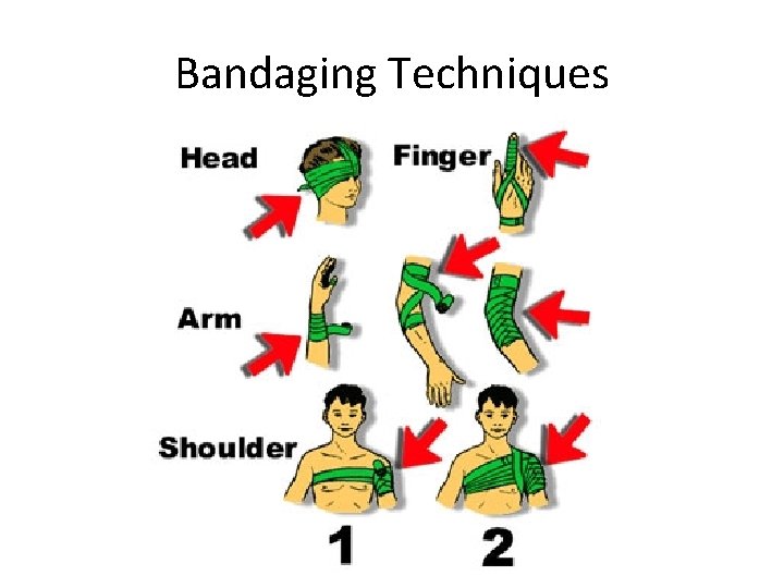Bandaging Techniques 