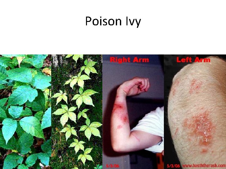 Poison Ivy 