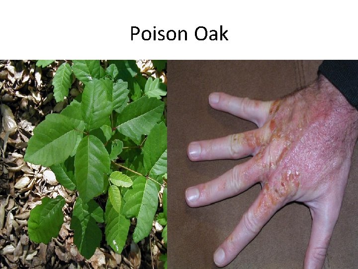 Poison Oak 