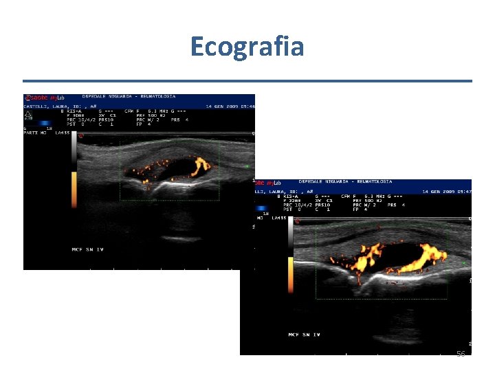 Ecografia 56 