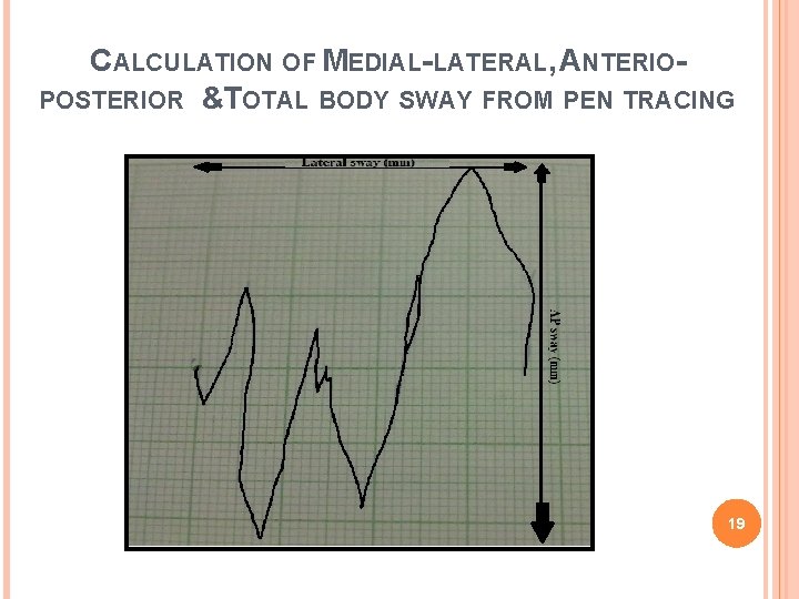 CALCULATION OF MEDIAL-LATERAL, ANTERIOPOSTERIOR &TOTAL BODY SWAY FROM PEN TRACING 19 