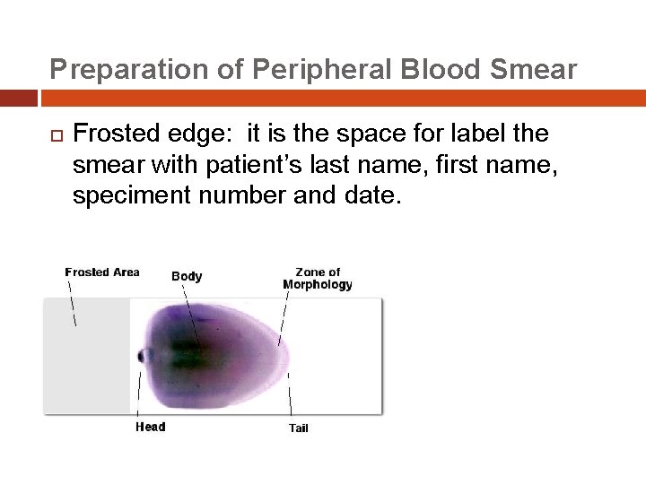 Preparation of Peripheral Blood Smear Frosted edge: it is the space for label the