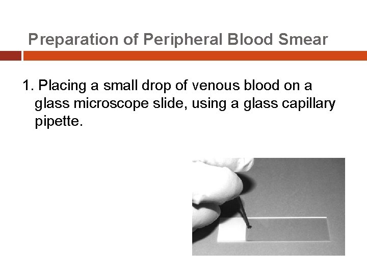 Preparation of Peripheral Blood Smear 1. Placing a small drop of venous blood on