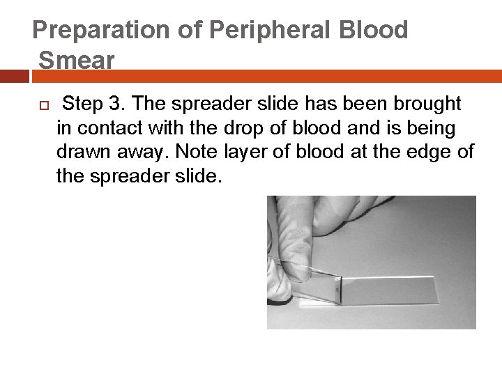 Preparation of Peripheral Blood Smear Step 3. The spreader slide has been brought in