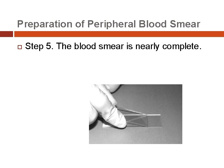 Preparation of Peripheral Blood Smear Step 5. The blood smear is nearly complete. 