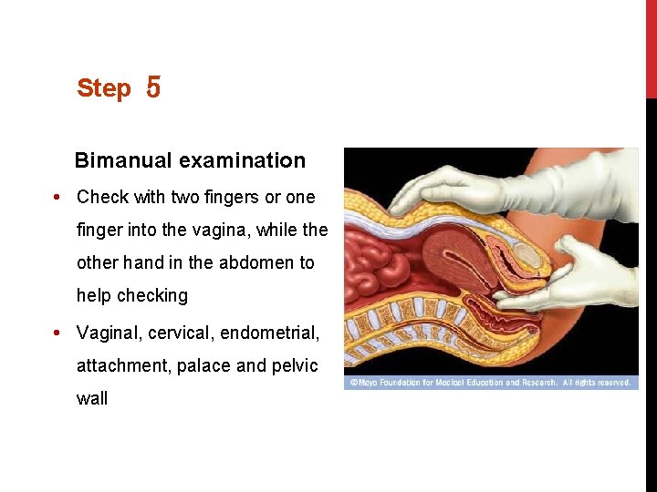 Step 5 Bimanual examination Check with two fingers or one finger into the vagina,