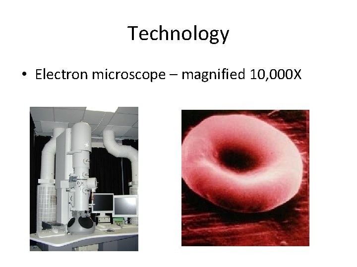 Technology • Electron microscope – magnified 10, 000 X 