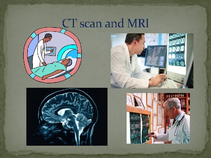 CT scan and MRI 