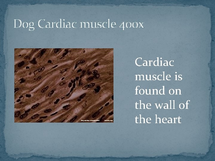 Dog Cardiac muscle 400 x Cardiac muscle is found on the wall of the