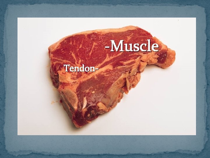 -Muscle Tendon- 