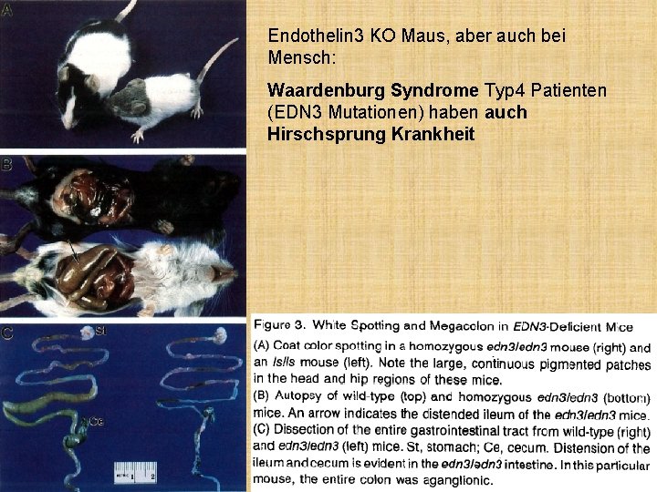 Endothelin 3 KO Maus, aber auch bei Mensch: Waardenburg Syndrome Typ 4 Patienten (EDN