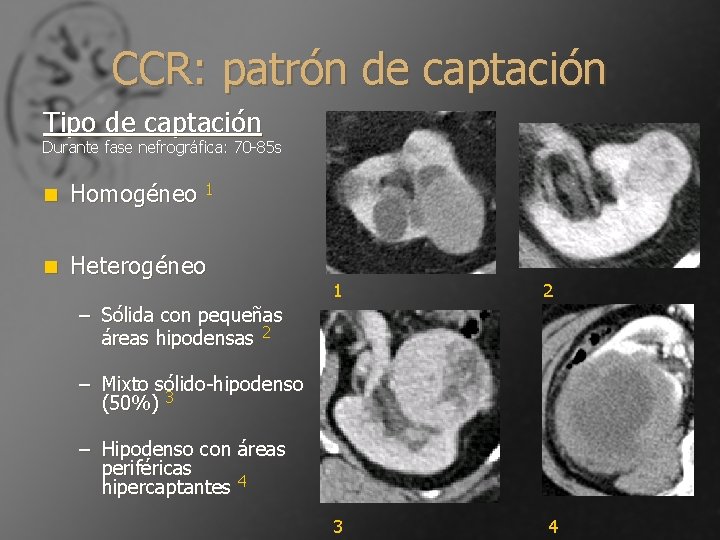 CCR: patrón de captación Tipo de captación Durante fase nefrográfica: 70 -85 s n