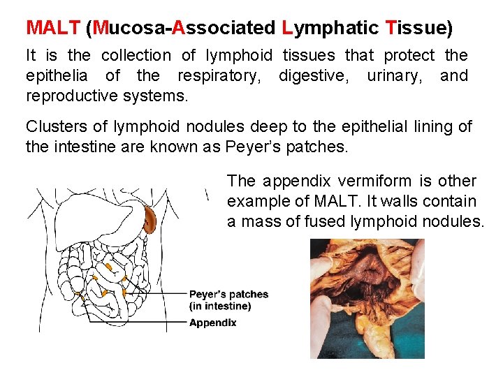 MALT (Mucosa-Associated Lymphatic Tissue) It is the collection of lymphoid tissues that protect the