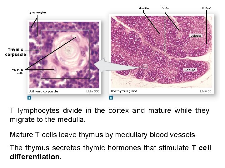 Medulla Septa Cortex Lymphocytes Lobule Thymic corpuscle Lobule Reticular cells A thymic corpuscle LM