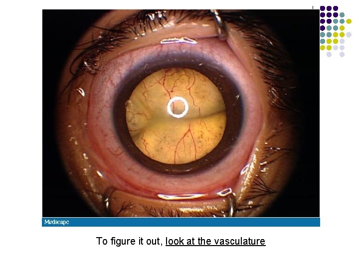 To figure it out, look at the vasculature 