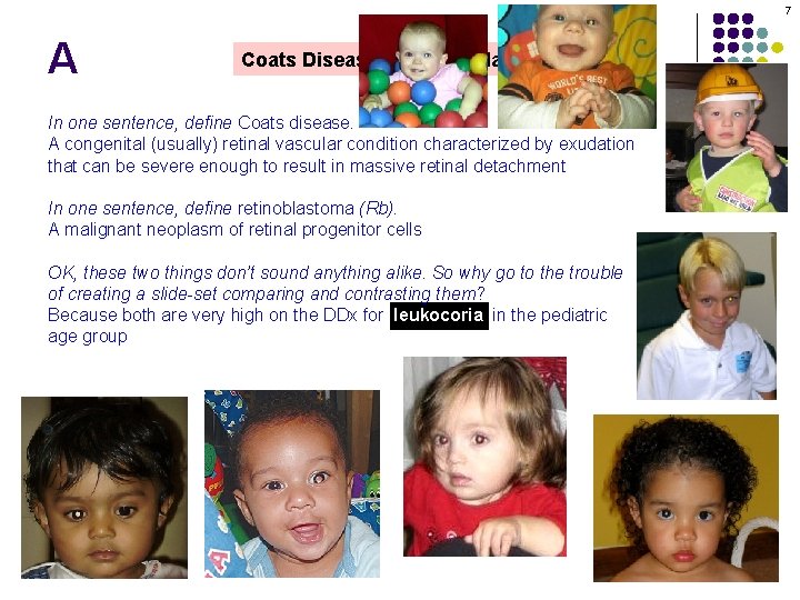 7 A Coats Disease vs Retinoblastoma In one sentence, define Coats disease. A congenital