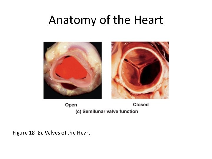 Anatomy of the Heart Figure 18– 8 c Valves of the Heart 