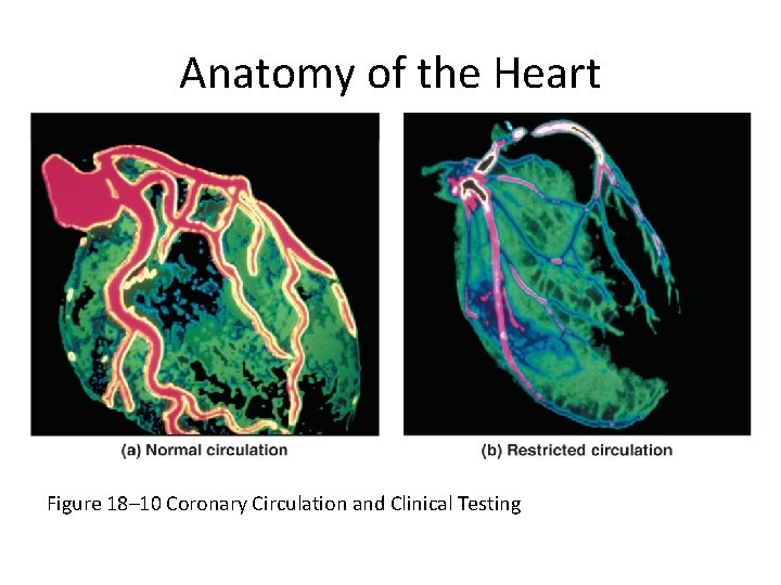 Anatomy of the Heart Figure 18– 10 Coronary Circulation and Clinical Testing 